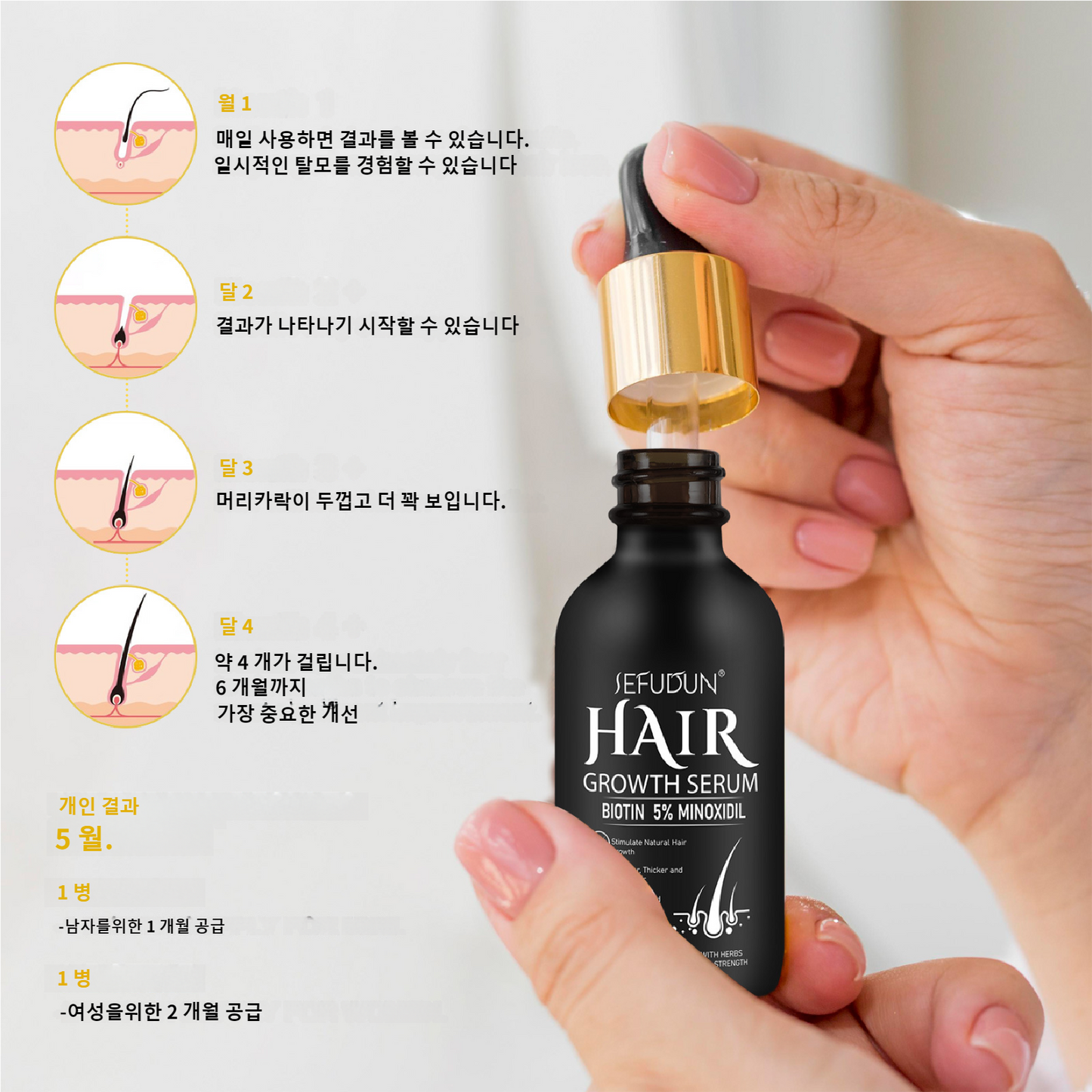 롤러형 헤어 그로스 세럼 두피 케어 마이크로니들 더마 롤러