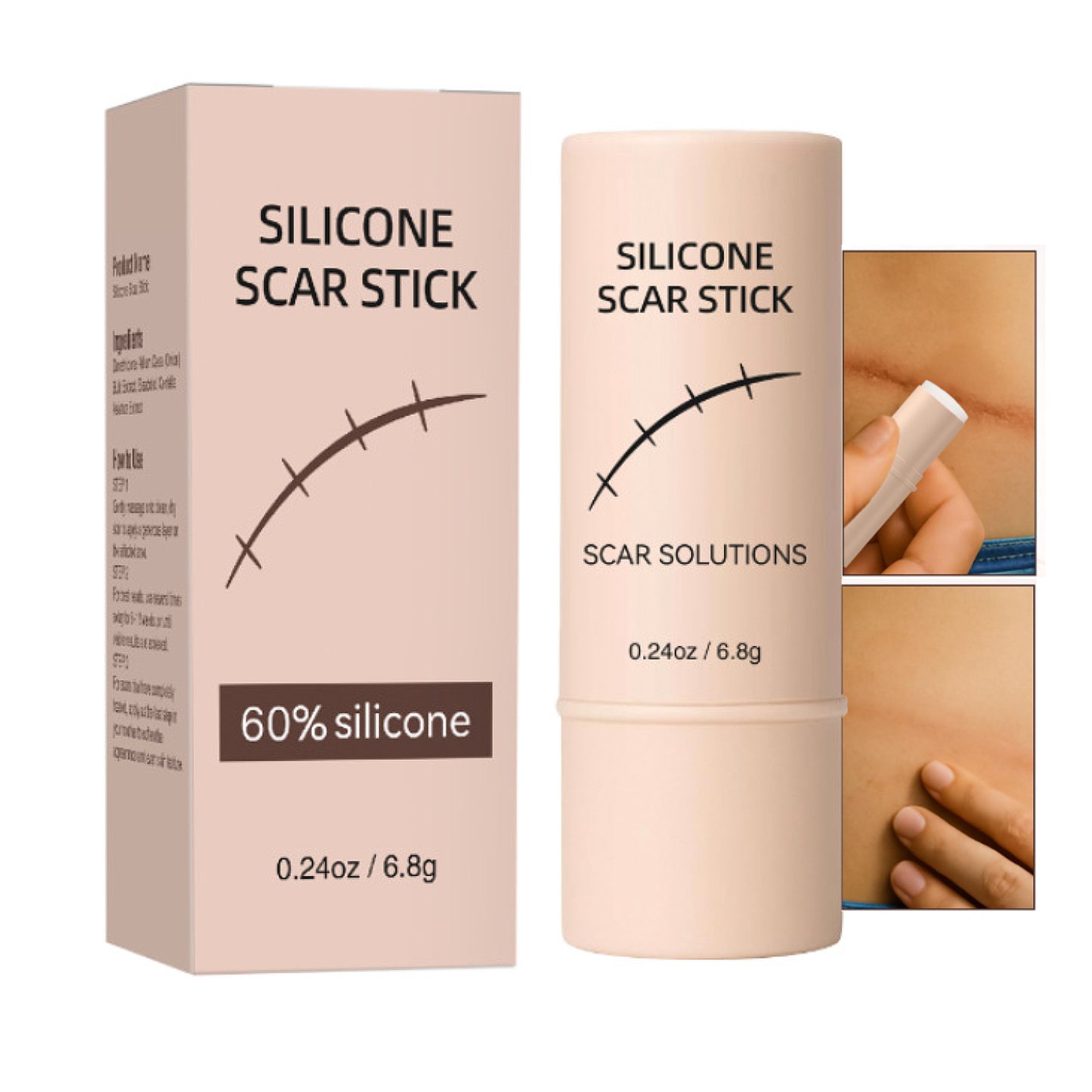 흉터 케어 스틱 실리콘 케어 스틱 60% 함유 페이스 바디 겸용 모든 피부용