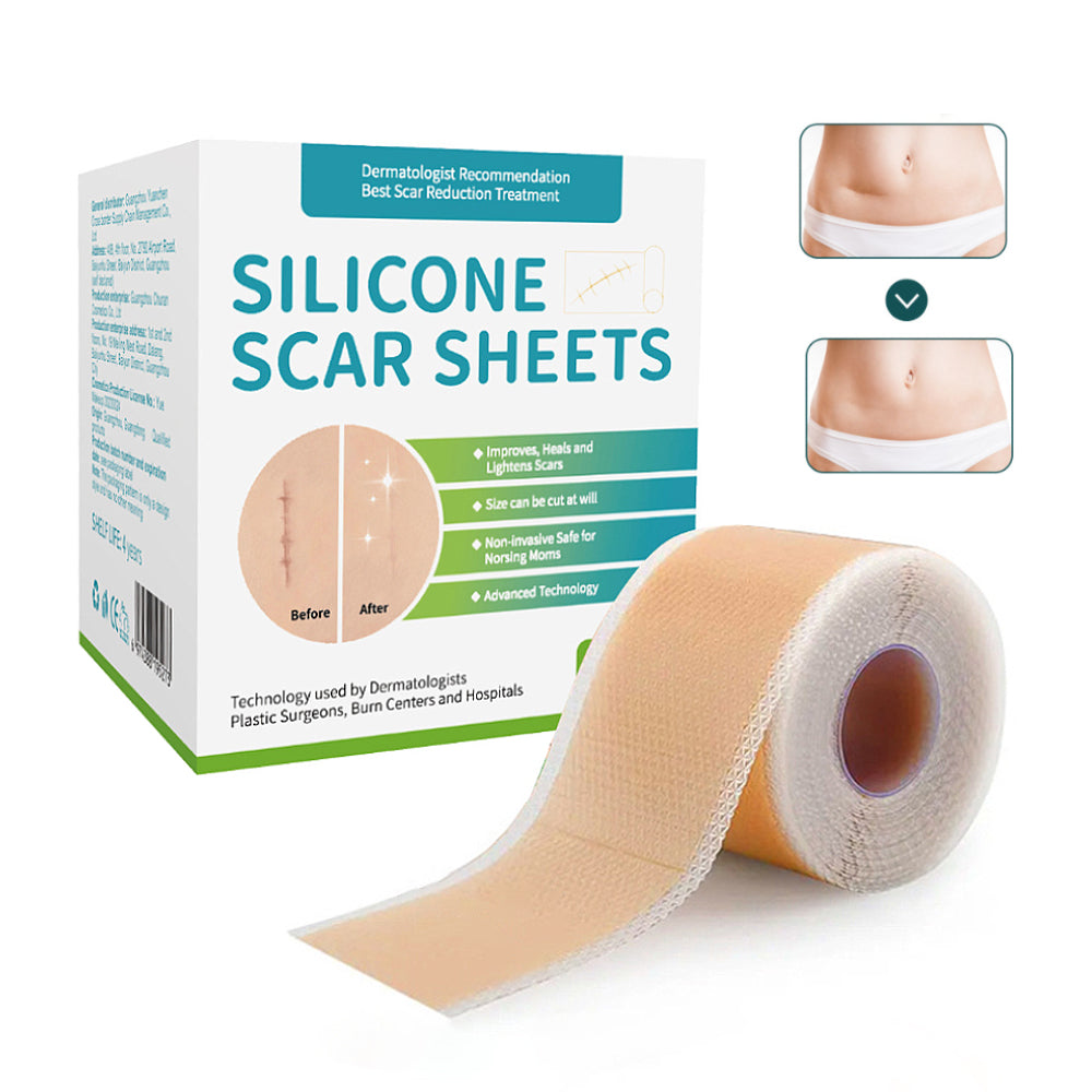 실리콘 흉터 케어 겔 시트 패치, 수술 부위 켈로이드 관리, 얼굴 바디 겸용