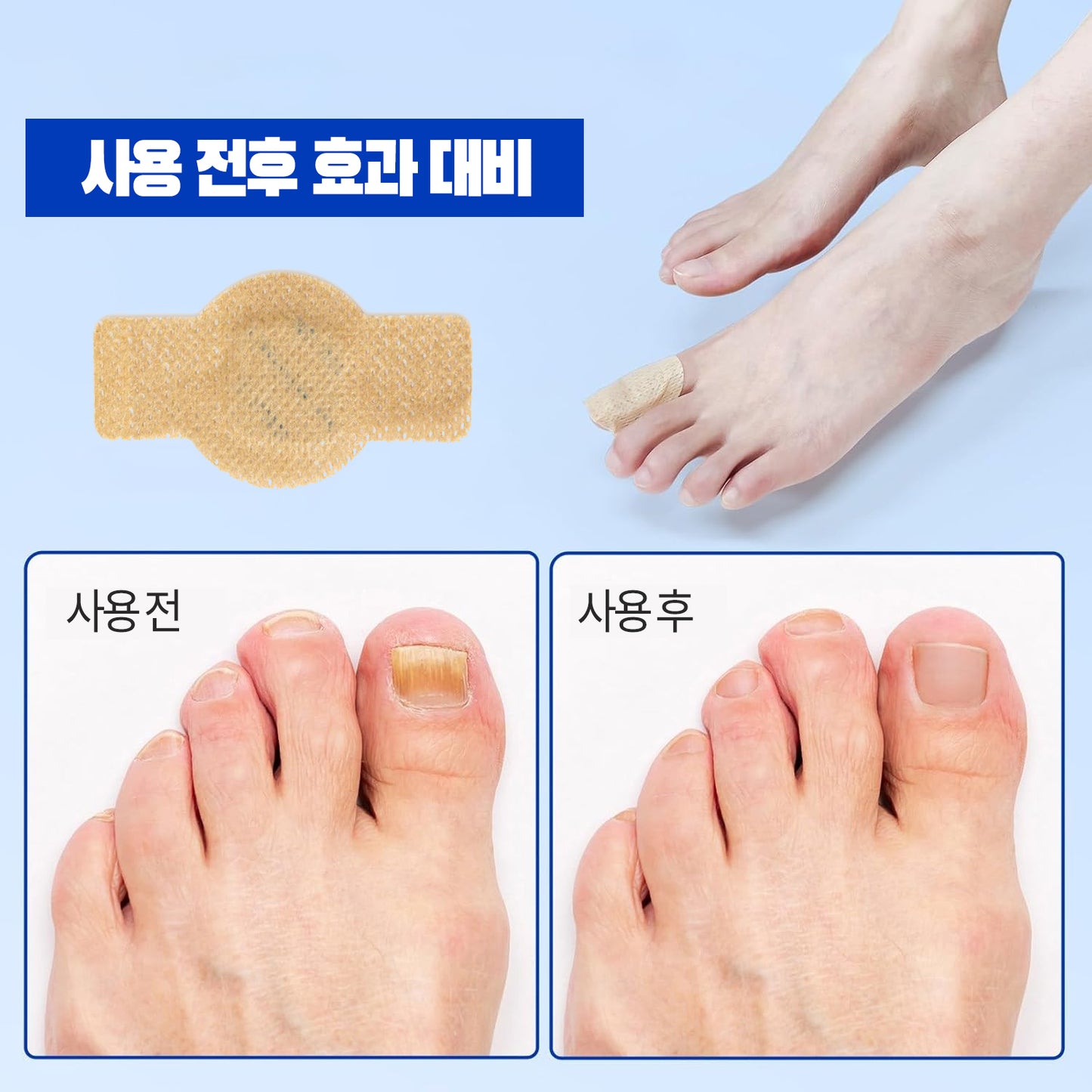 엘라이메이 네일항균 가려움방지 풋케어 패치 비공구오