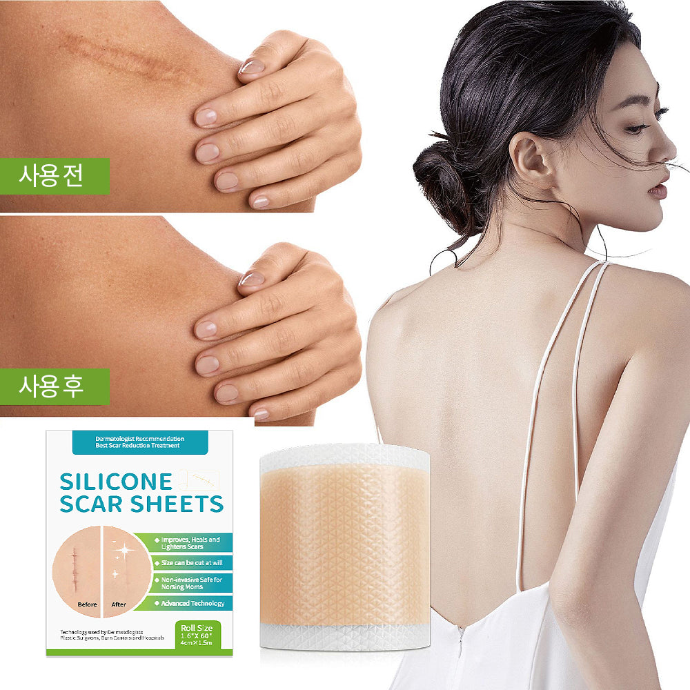 실리콘 흉터 케어 겔 시트 패치, 수술 부위 켈로이드 관리, 얼굴 바디 겸용