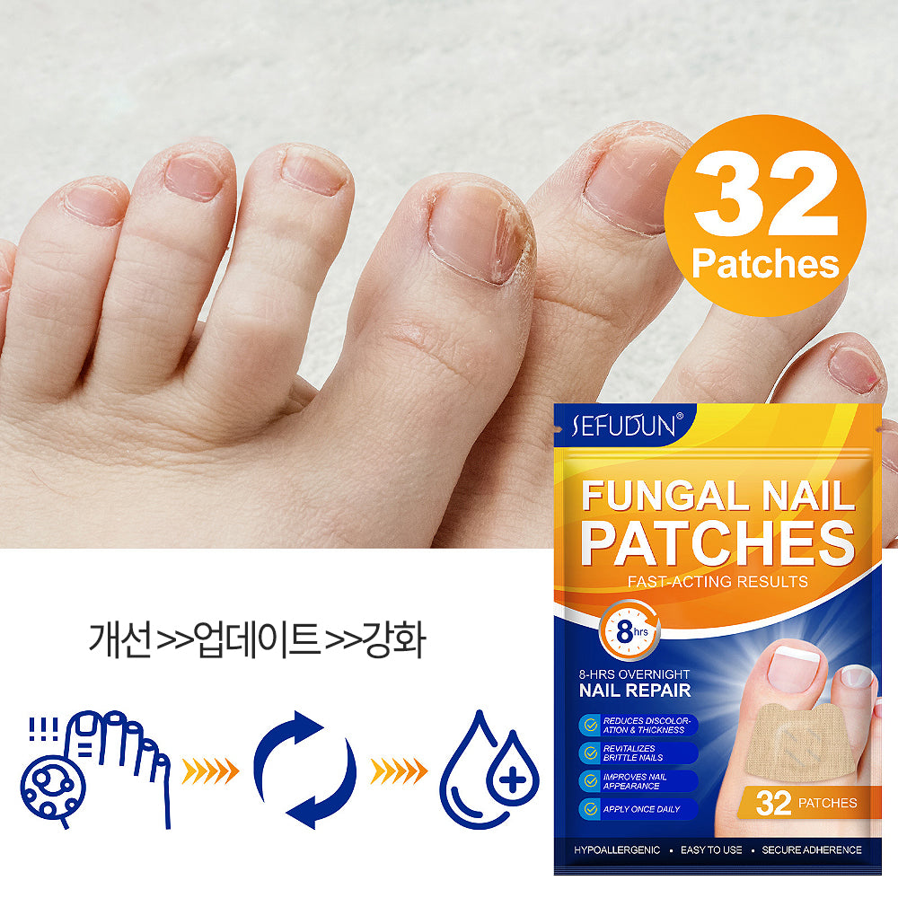 SEFUDUN 내성발톱 교정 테이프 32매 손발톱 항균 케어