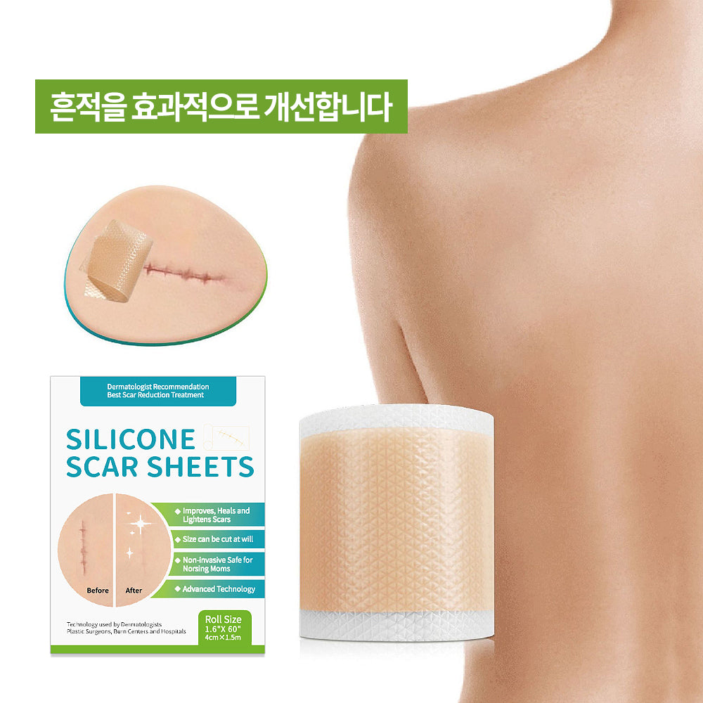 실리콘 흉터 케어 겔 시트 패치, 수술 부위 켈로이드 관리, 얼굴 바디 겸용