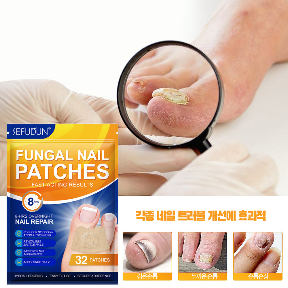 SEFUDUN 내성발톱 교정 테이프 32매 손발톱 항균 케어