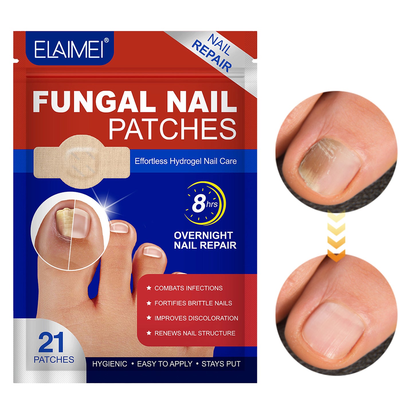 엘라이메이 네일항균 가려움방지 풋케어 패치 비공구오