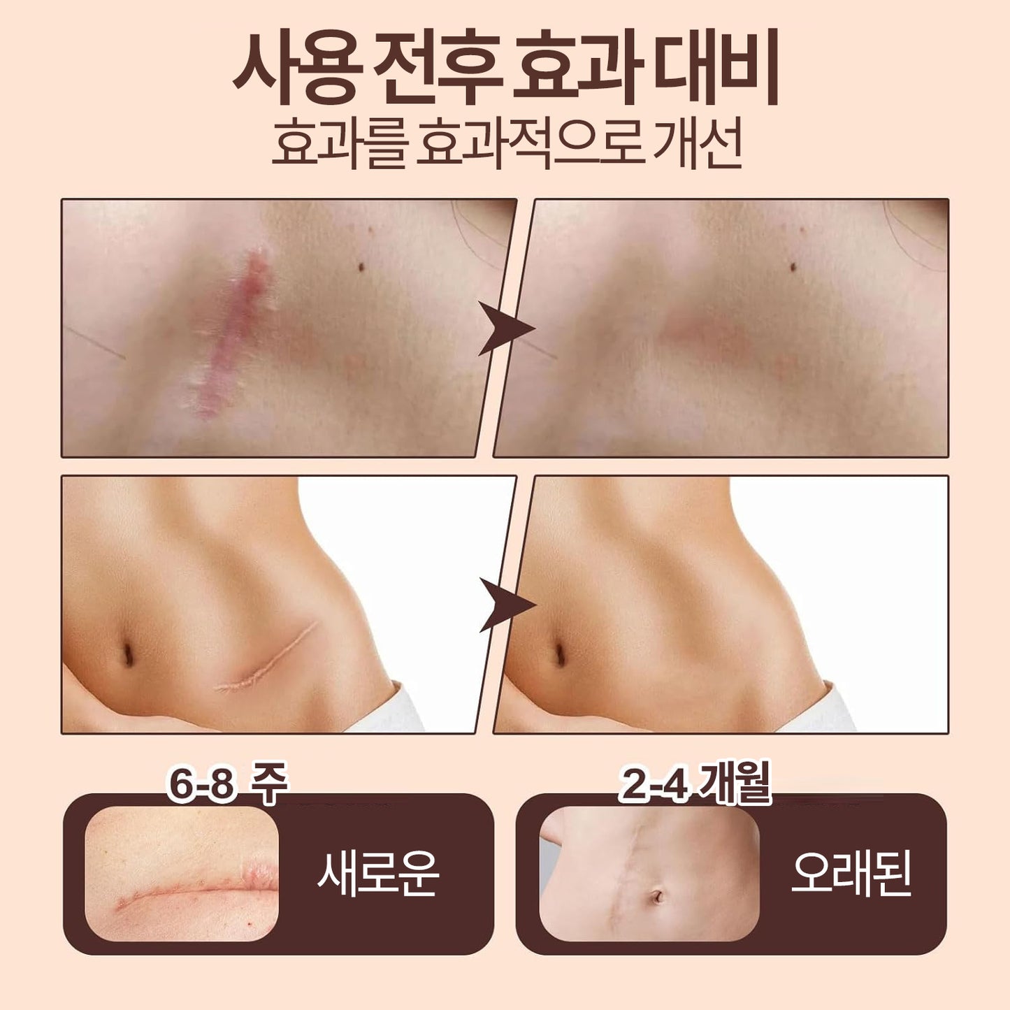 흉터 케어 스틱 실리콘 케어 스틱 60% 함유 페이스 바디 겸용 모든 피부용