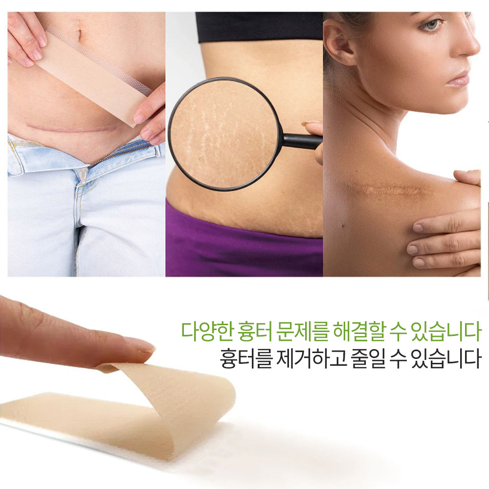 실리콘 흉터 케어 겔 시트 패치, 수술 부위 켈로이드 관리, 얼굴 바디 겸용