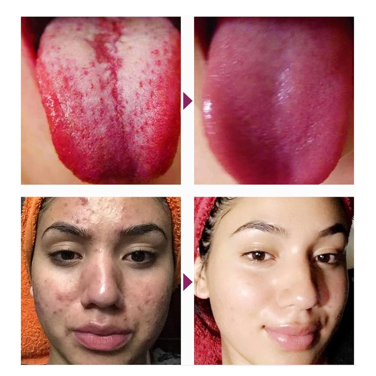 ELAIMEI 디톡스 발패치 10매 대나무식초 생강 쑥 수액시트